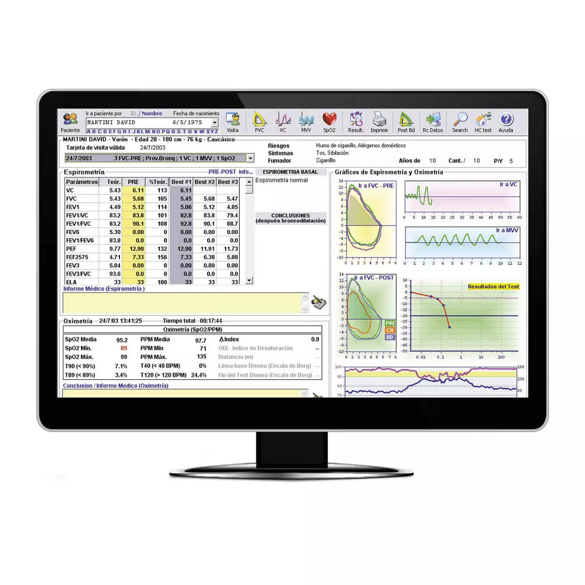  MIR Minispir Spirometer