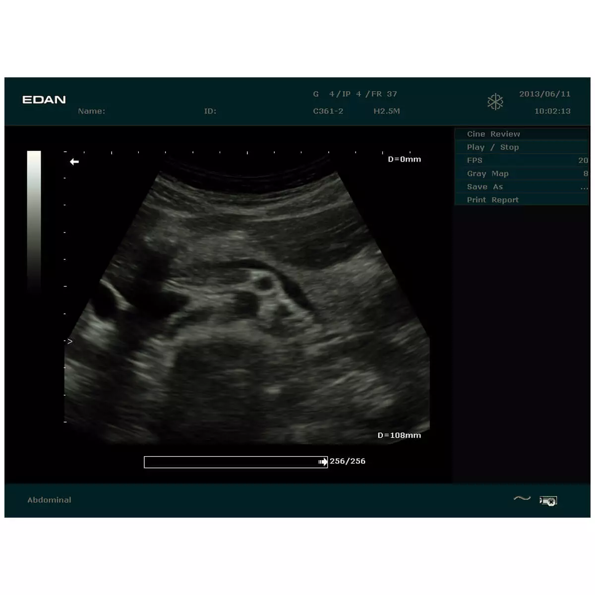  DUS 60 echografie scanner