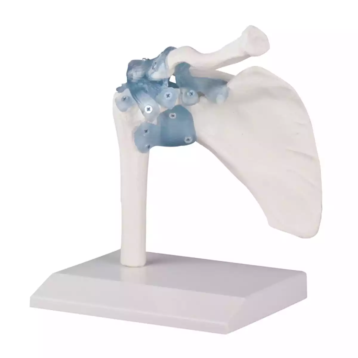  Schoudergewricht model