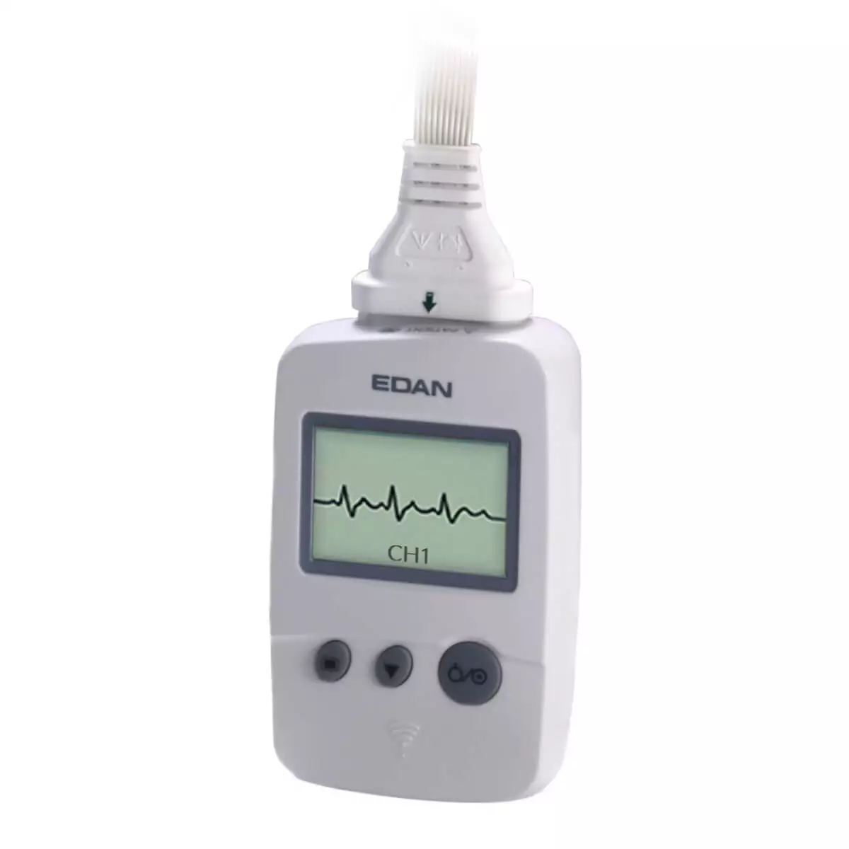  SE-1515 ECG-gegevensbeheersoftware