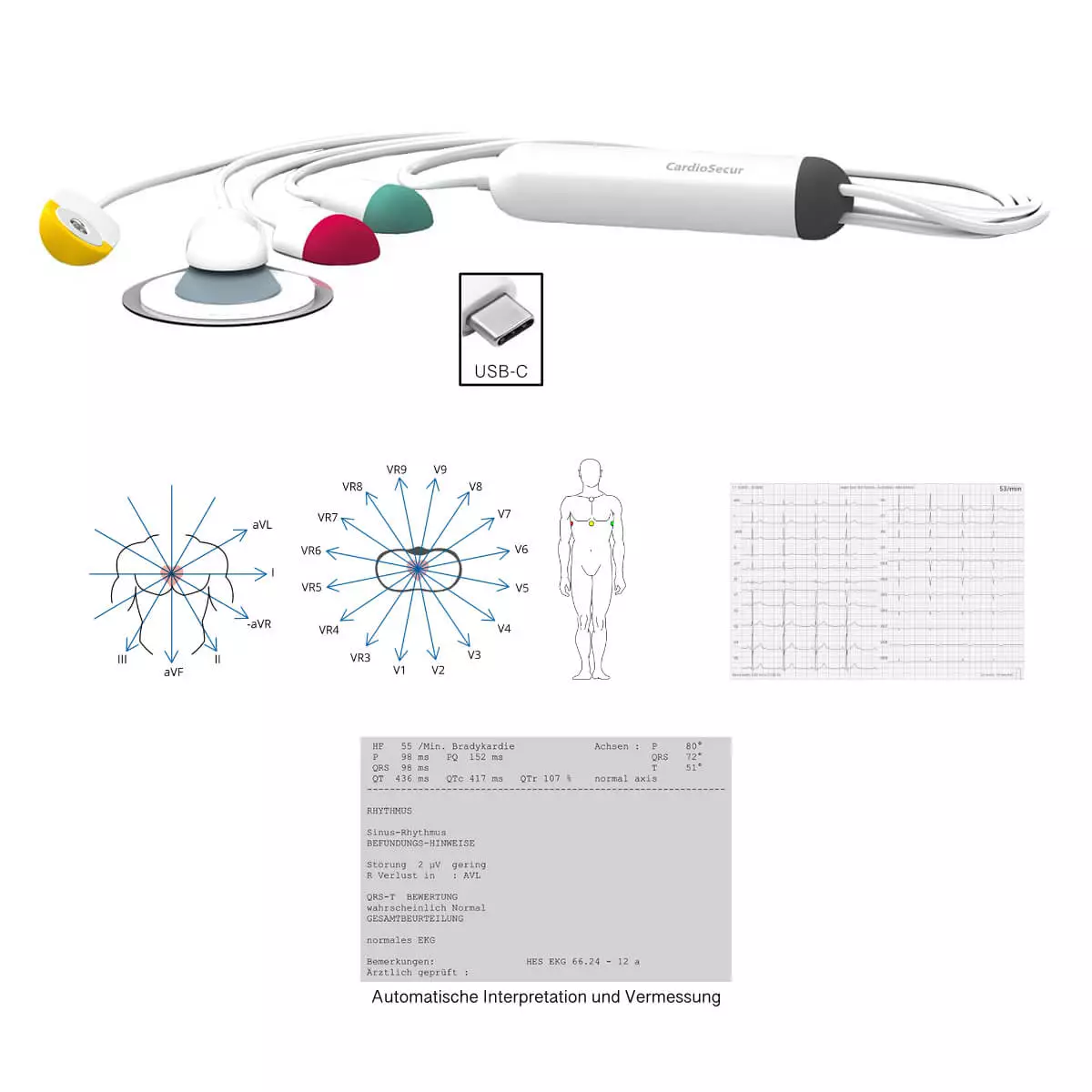 CardioSecur Pro ECG CardioSecur Pro ECG