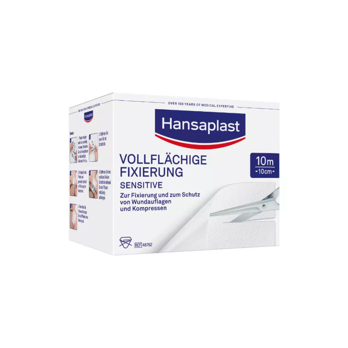 Volledige oppervlakte fixatie Volledige oppervlakte fixatie