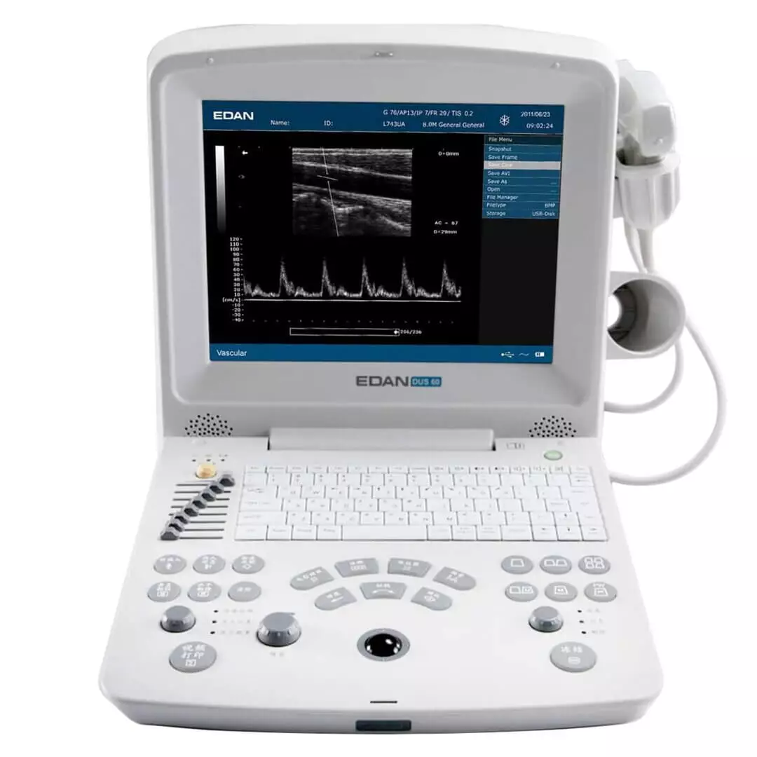  DUS 60 echografie scanner
