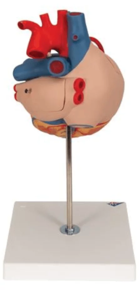  Modelhart met bypass