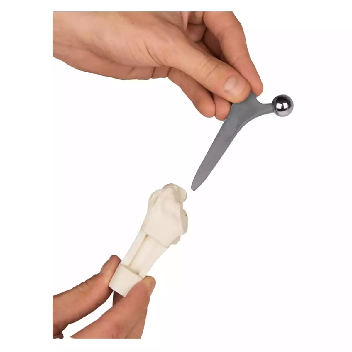  Model heupimplantaat