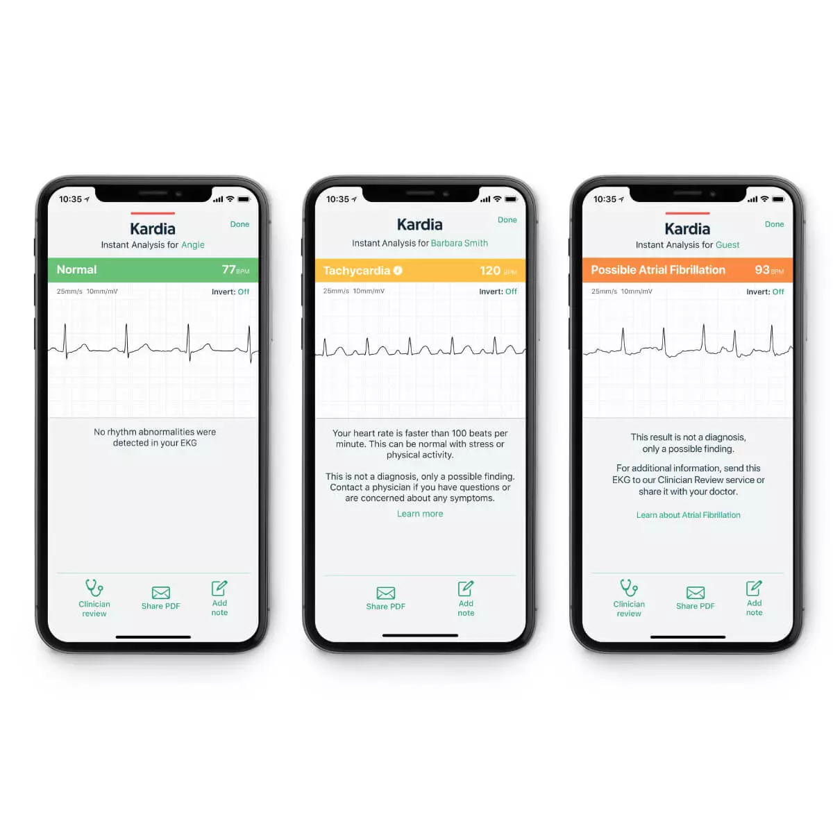  KardiaMobile® Smartphone 1-kanaals ECG