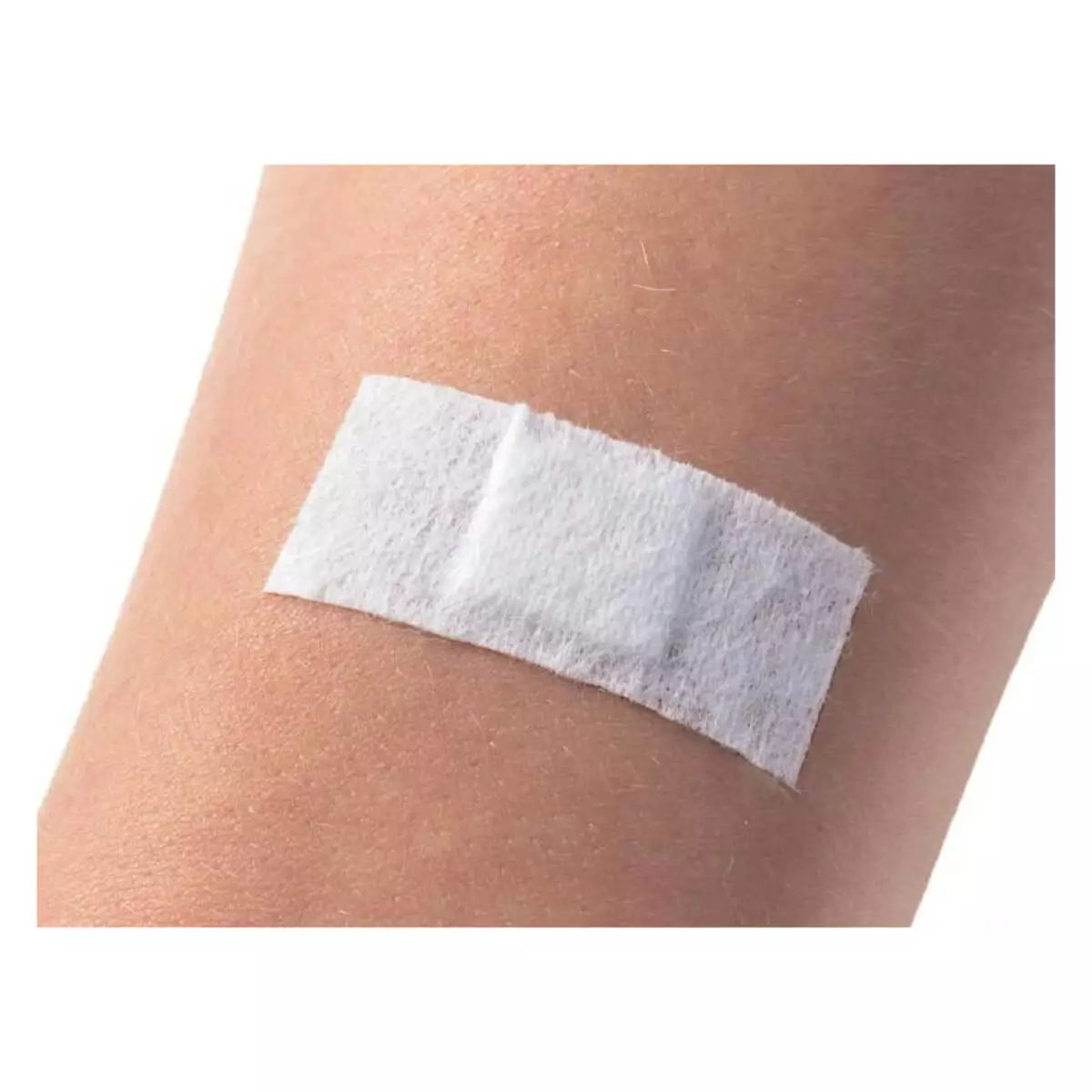  Injectie wondpleister