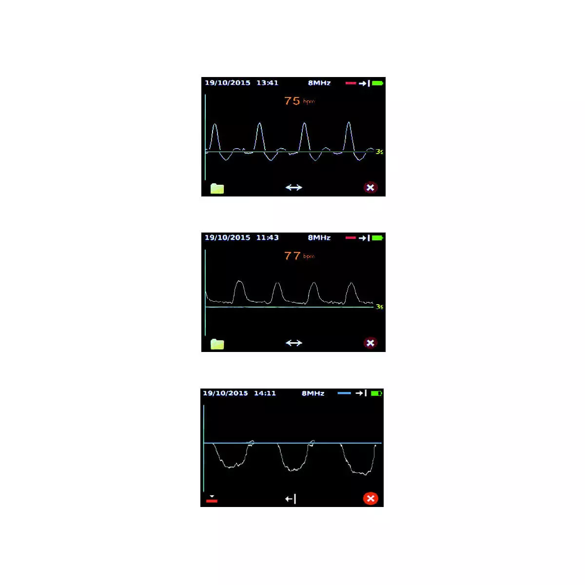  Dopplex DMX vasculaire doppler