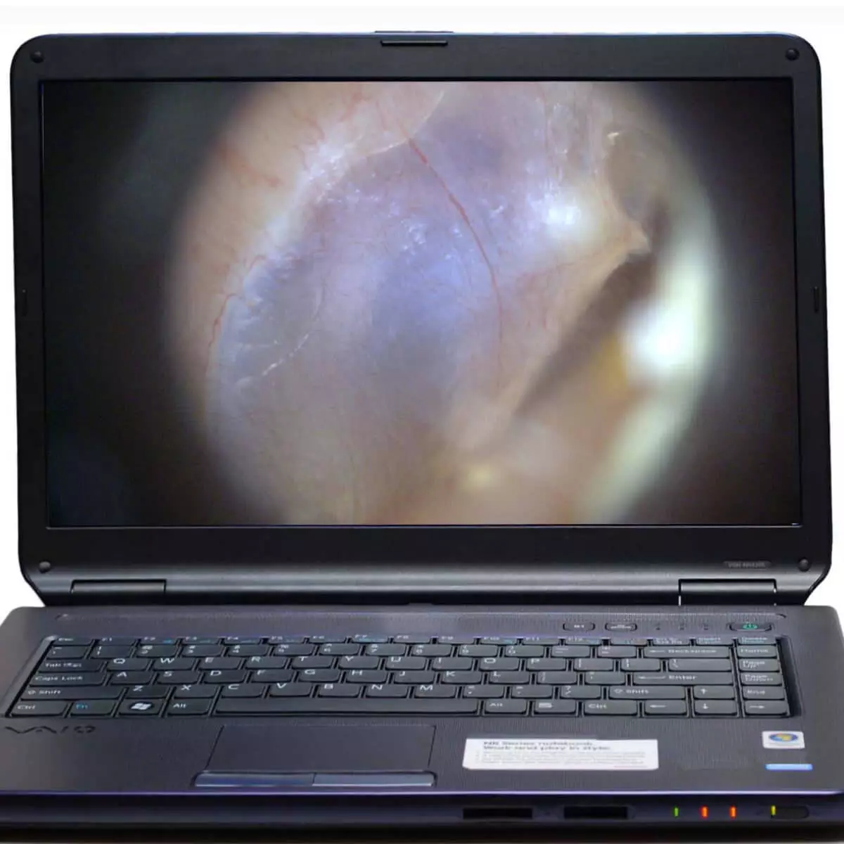  EarScope Pro Wireless video-otoscoop