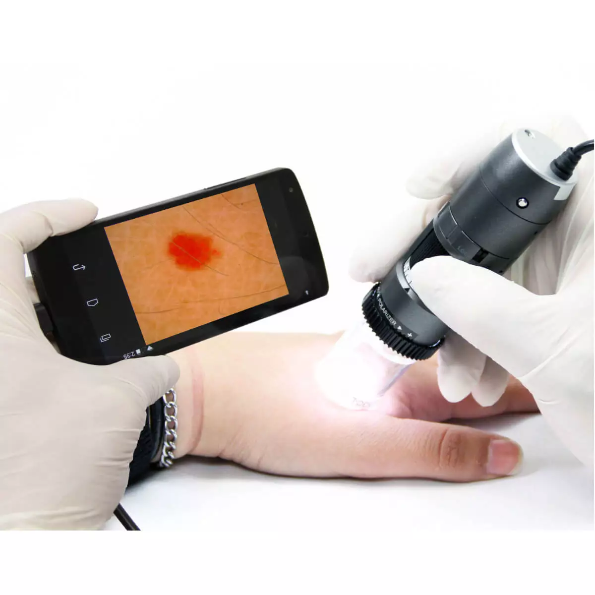  DermaScope Polarizer HR 200x videodermatoscoop
