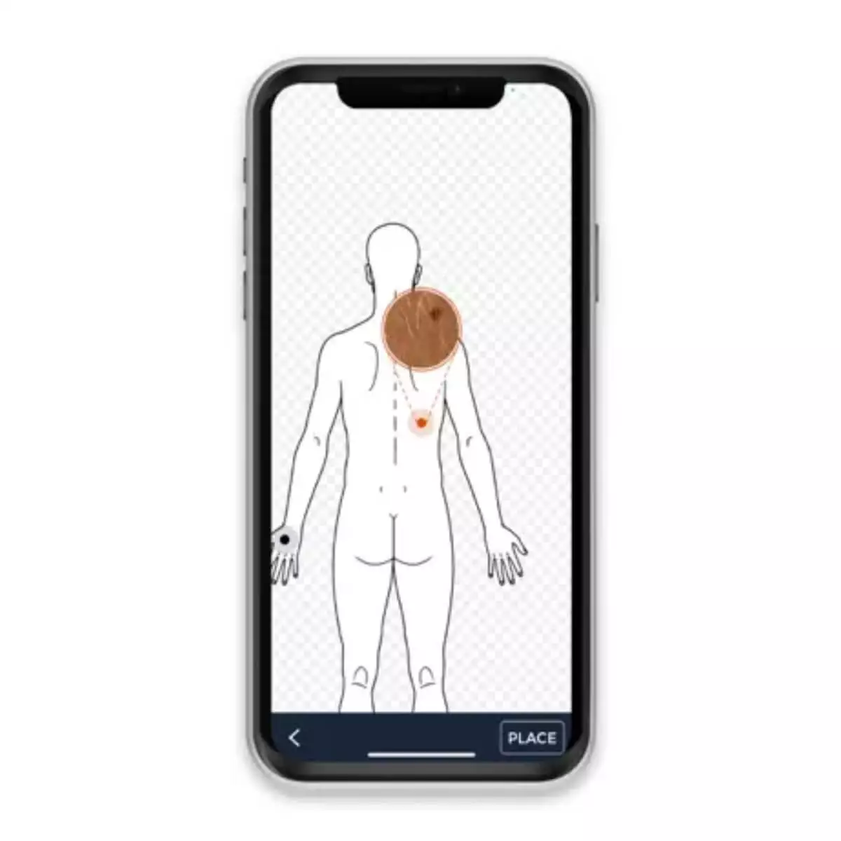  HEINE iC1 dermatoscoop