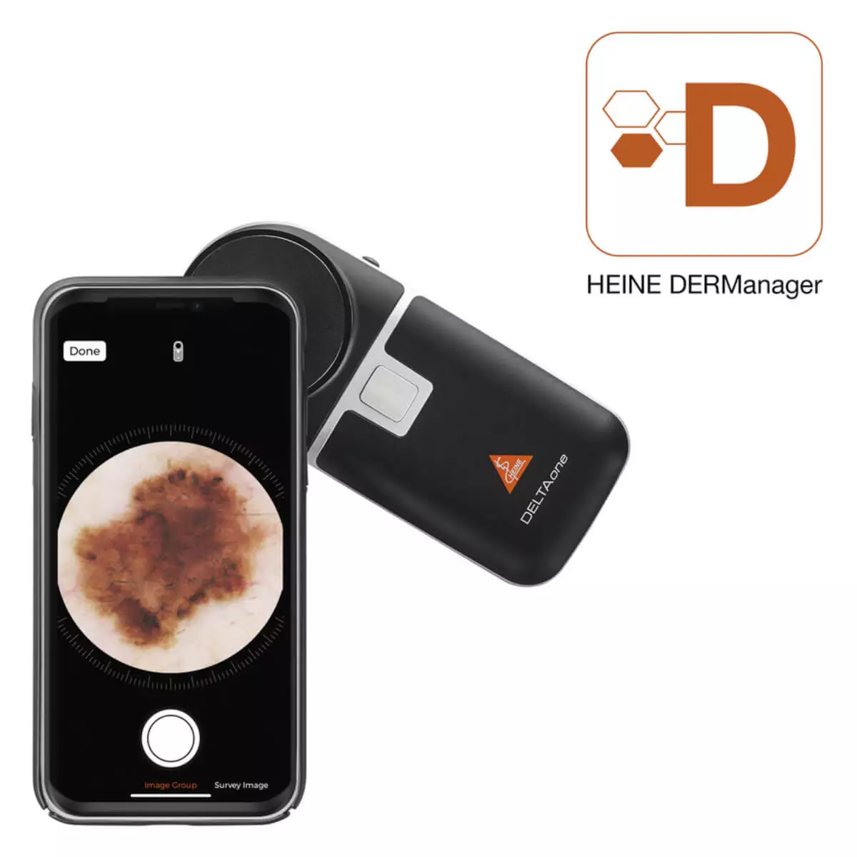  HEINE DELTAone Dermatoscoop