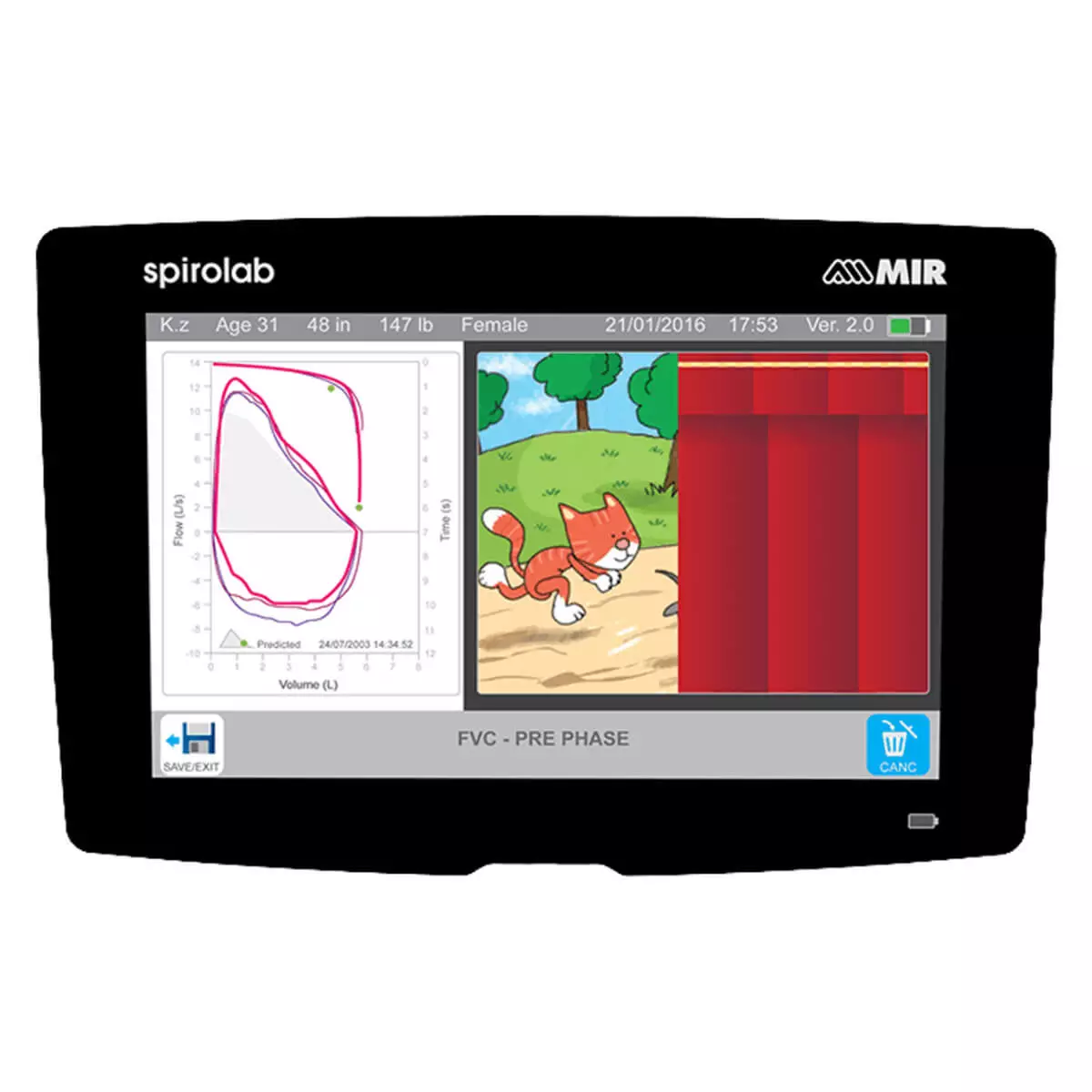  Nieuwe Spirolab draagbare touchscreen-spirometer