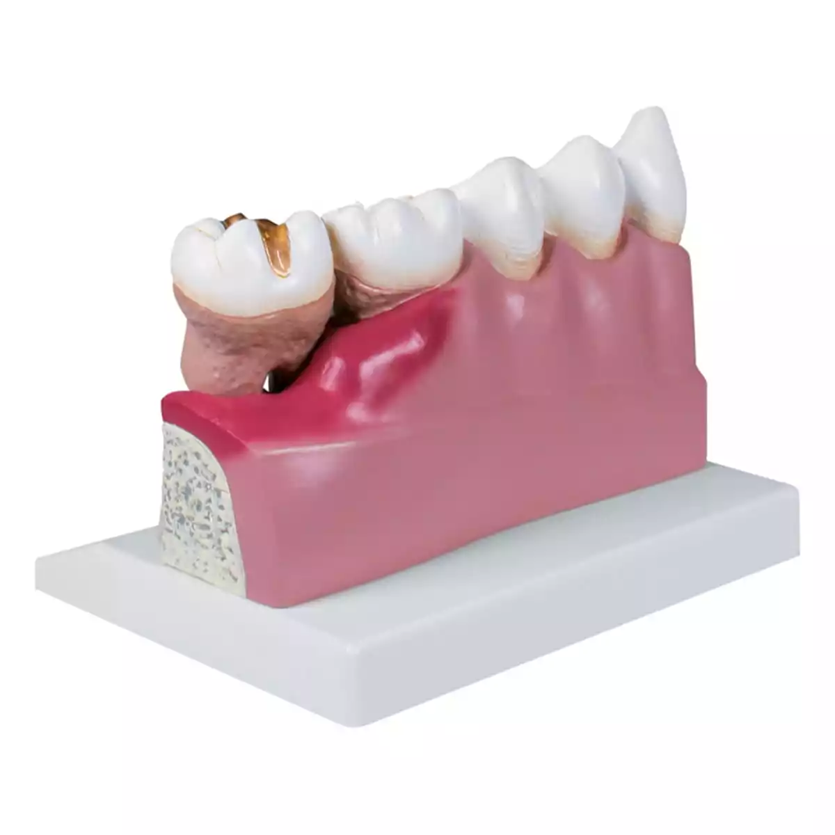  Dentalmodell