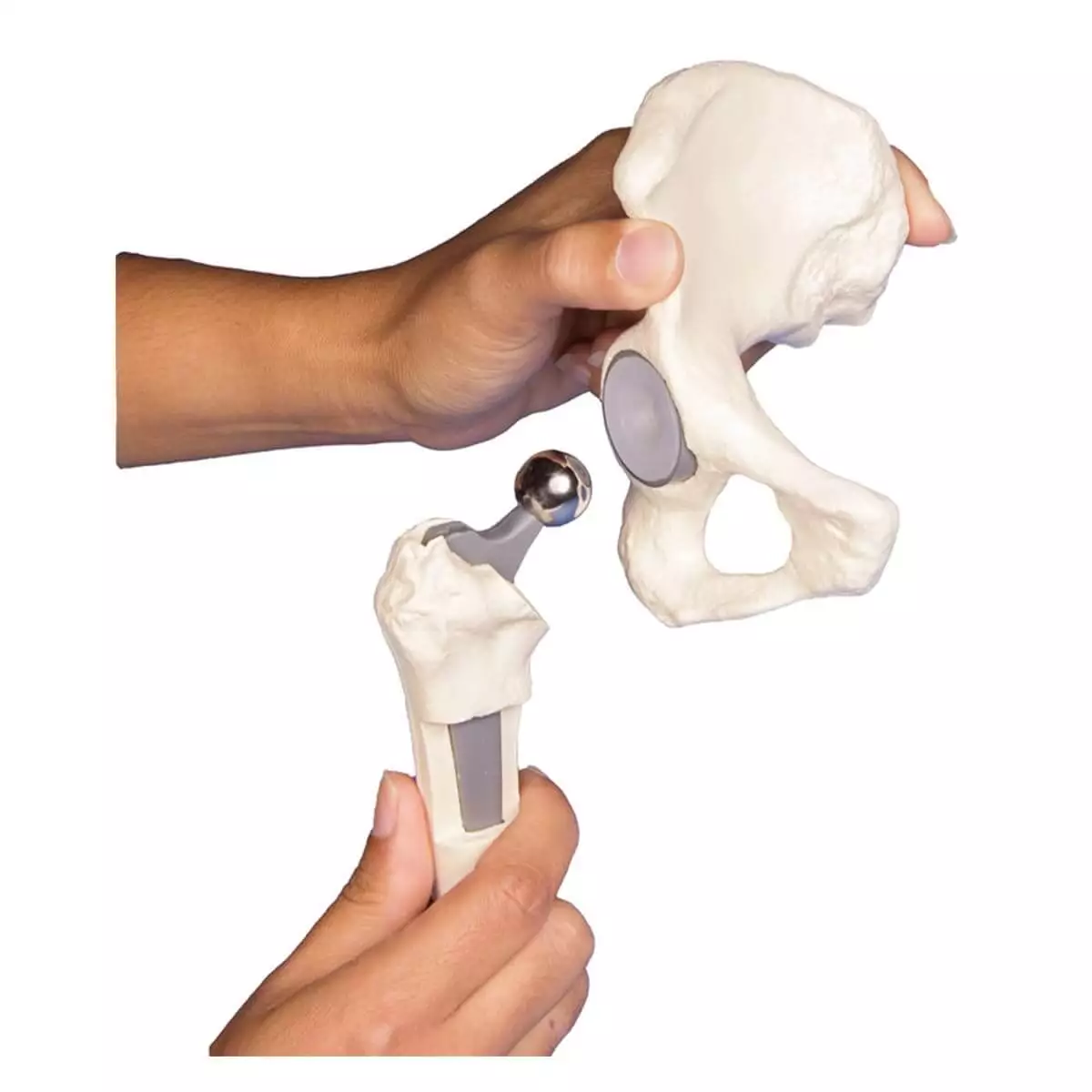  Model heupimplantaat