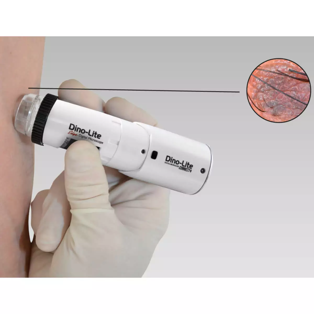  DermaScope Polarizer Wireless videodermatoscoop