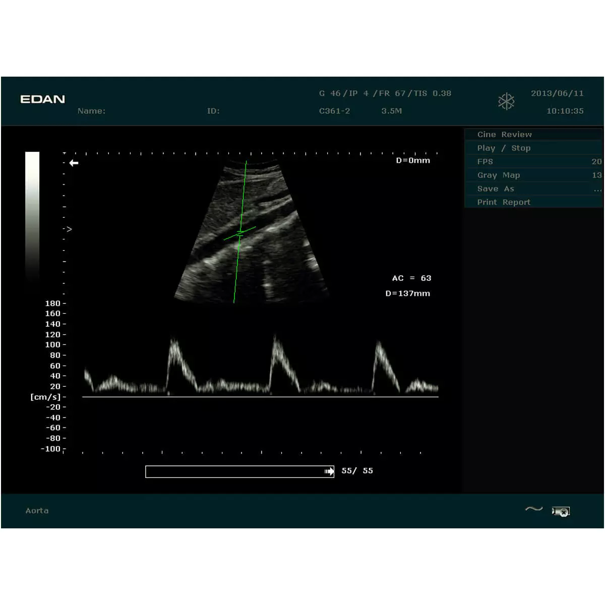  DUS 60 echografie scanner
