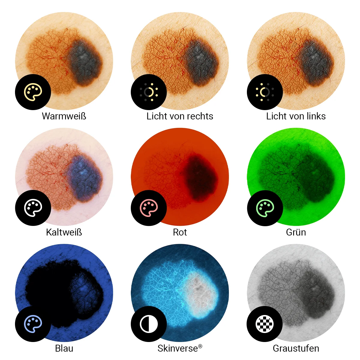  Digitale dermatoscoop ‘Scaut®’