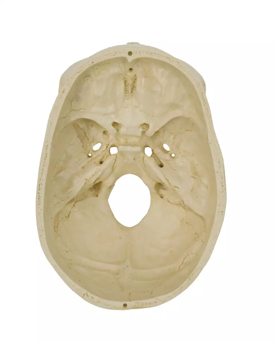  Schedel-model