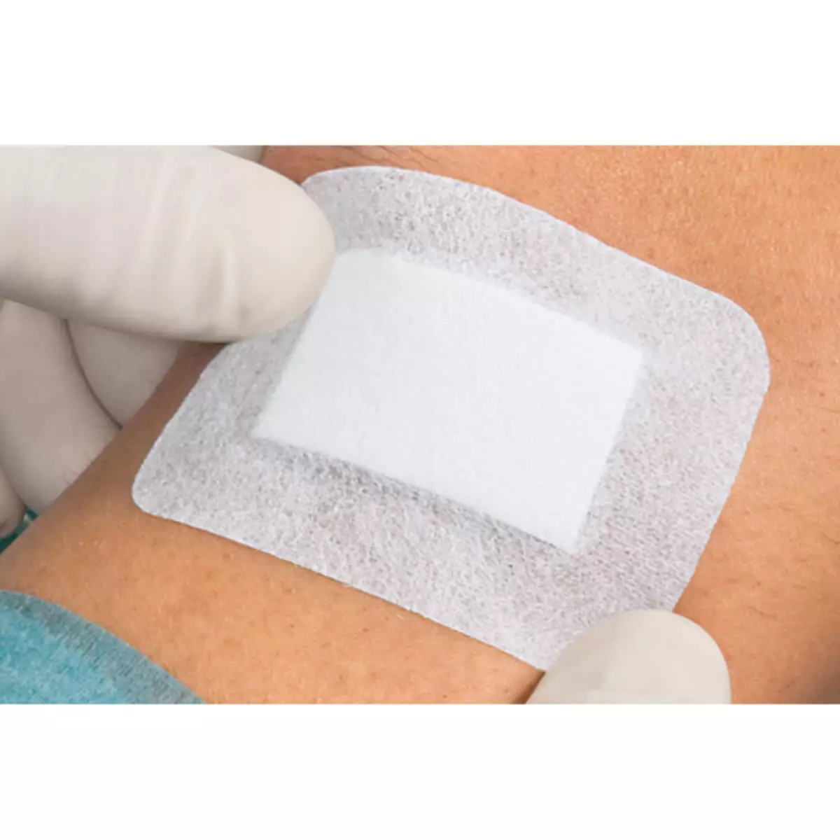  Cosmopor Advance Wundverband