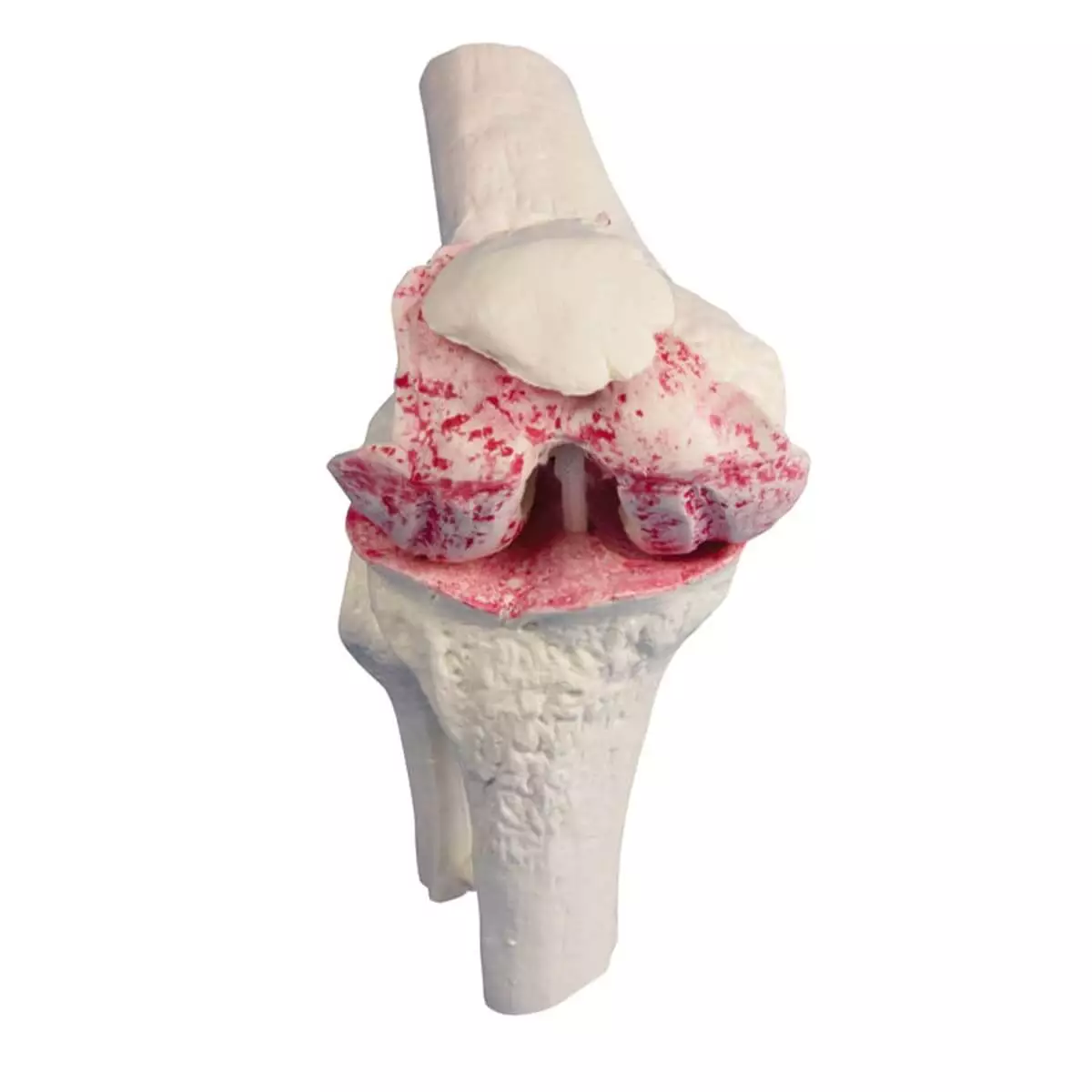  Model voor knie-implantaten