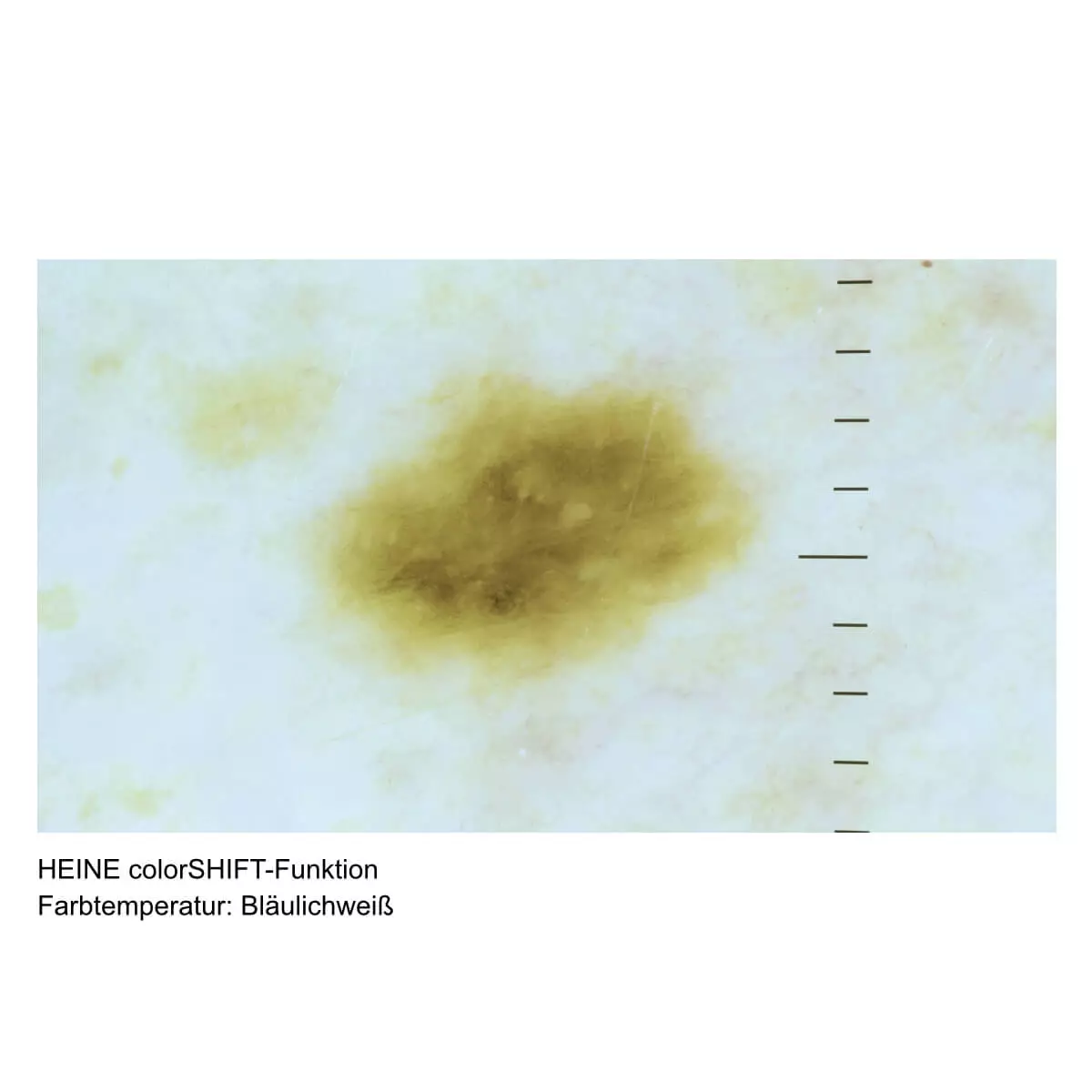 HEINE DELTA 30 PRO dermatoscoop HEINE DELTA 30 PRO dermatoscoop