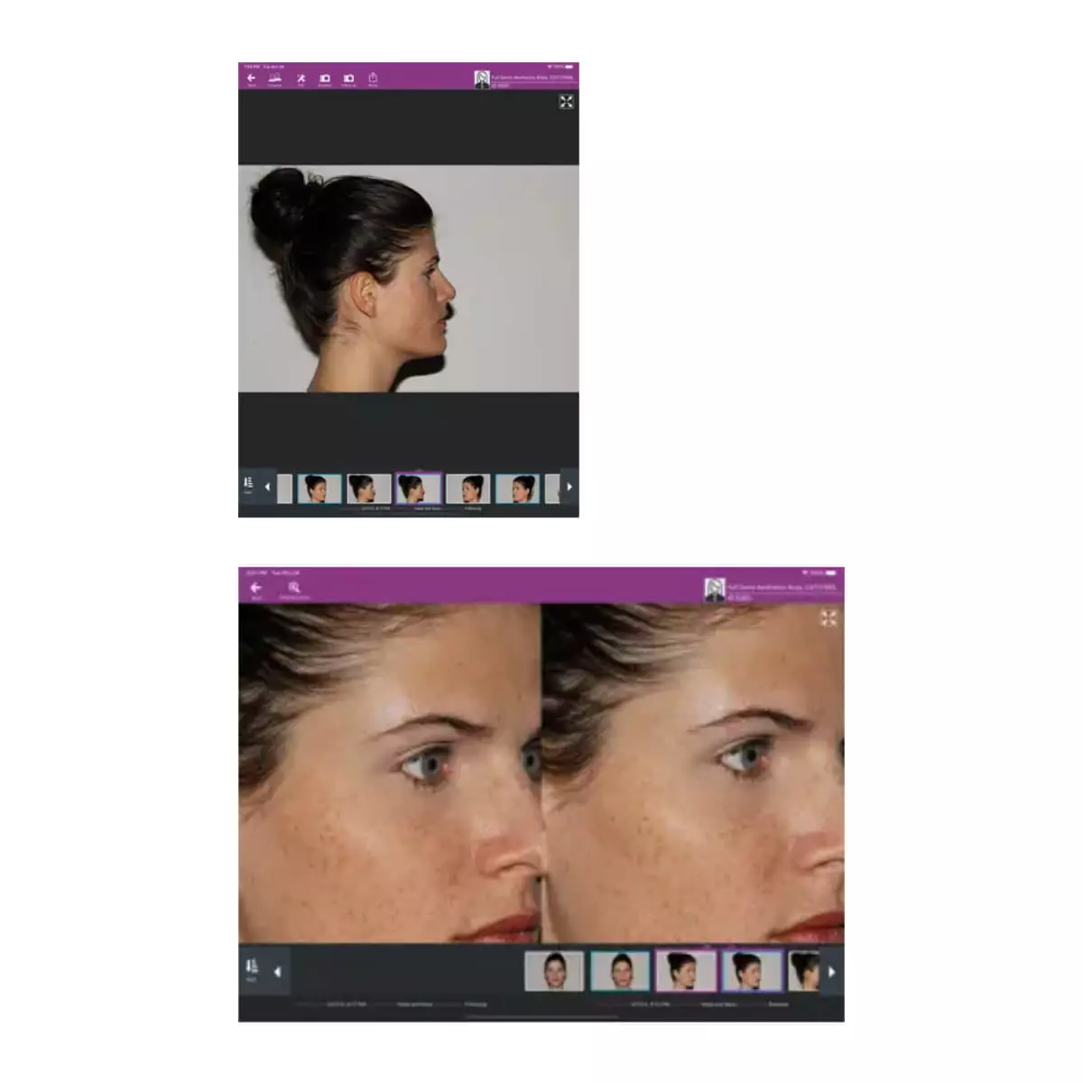  meesma beeldsysteem voor iOS & FotoFinder Hub clouddienst