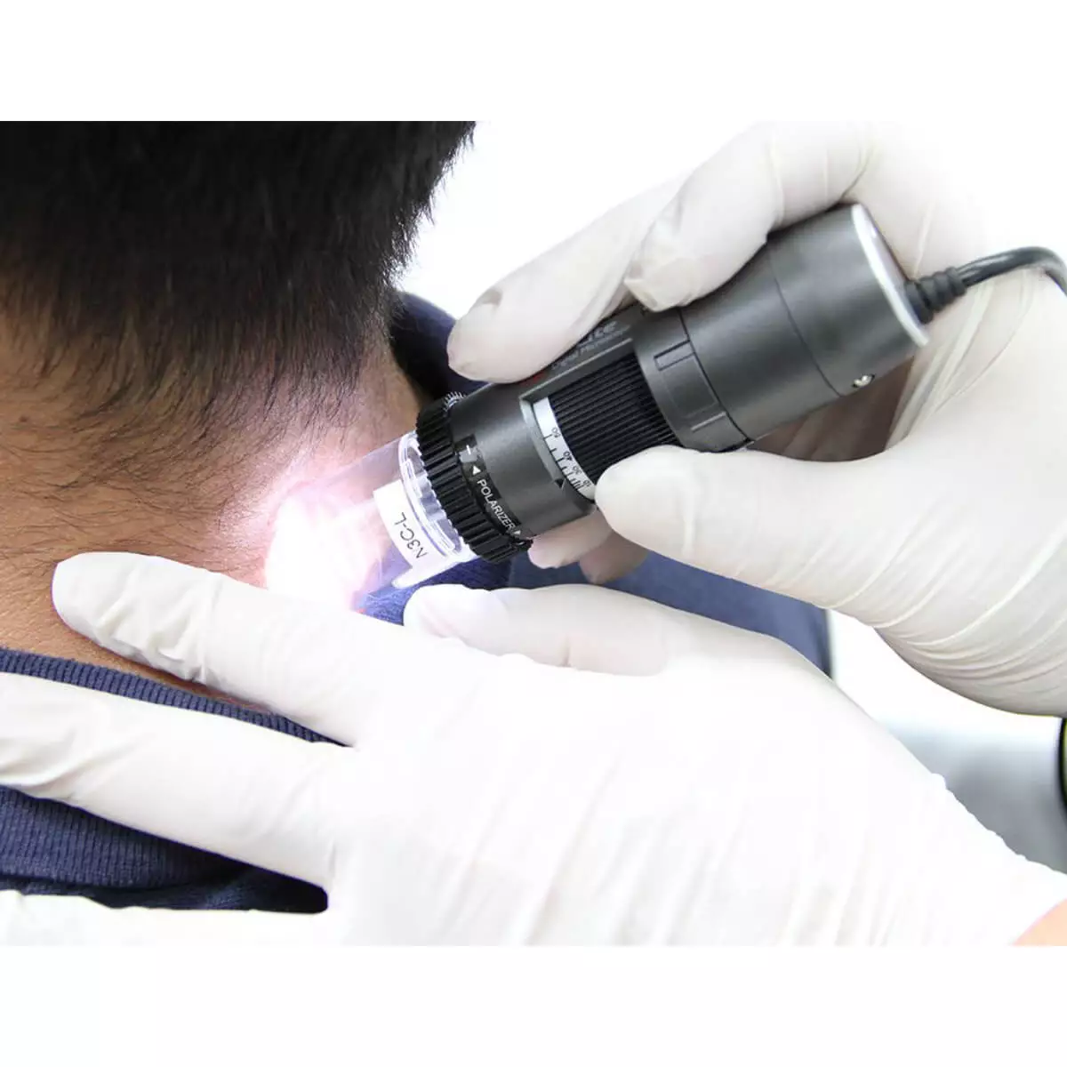  DermaScope Polarizer HR 200x videodermatoscoop