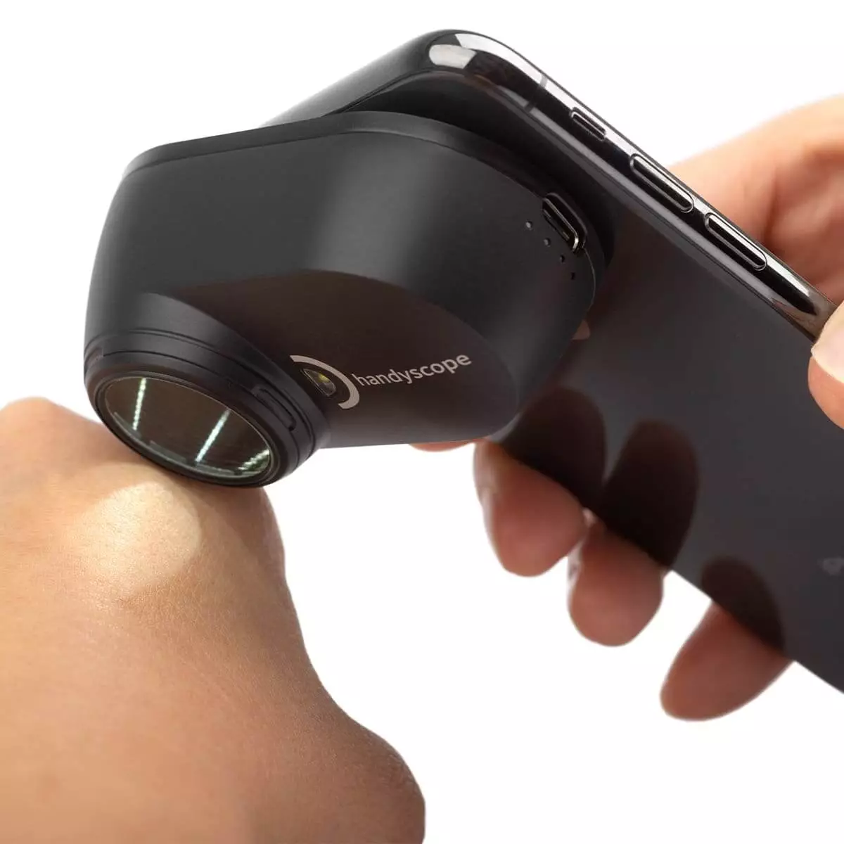  DermLite Handyscoop
