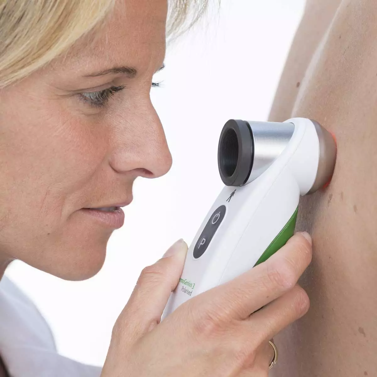  DermoGenius 3 gepolariseerde dermatoscoop