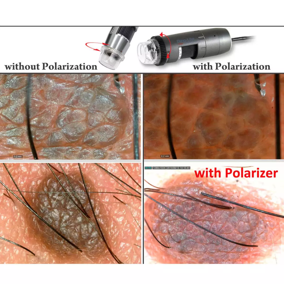  DermaScope Polarizer HR 200x videodermatoscoop