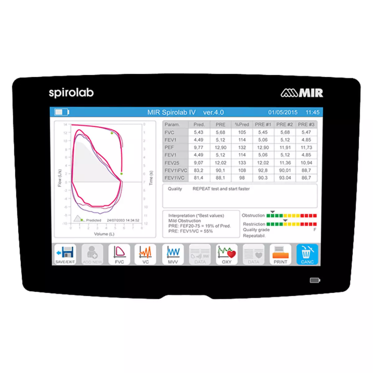  Nieuwe Spirolab draagbare touchscreen-spirometer