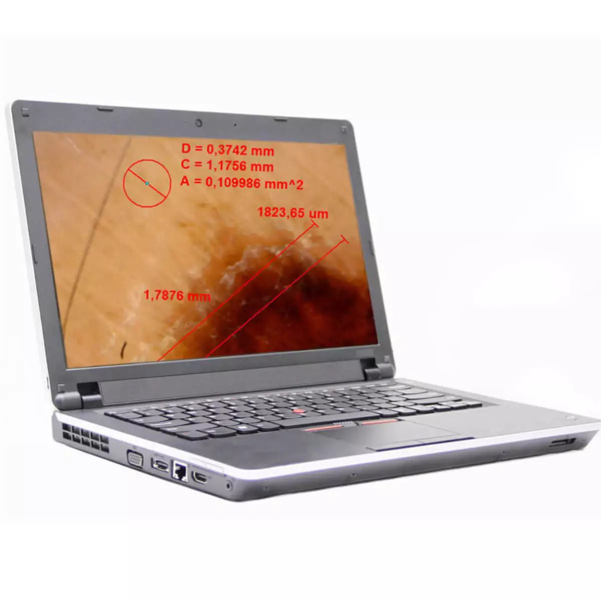  DermaScope Polarizer Wireless videodermatoscoop