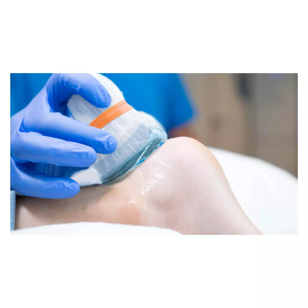  aiSon FOCUS gelpads voor echotransducers