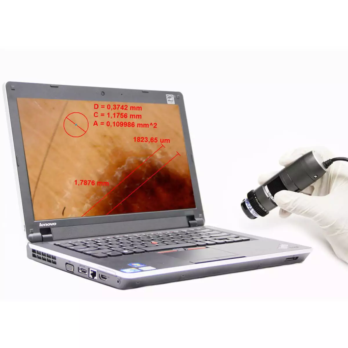  DermaScope Polarizer HR 200x videodermatoscoop