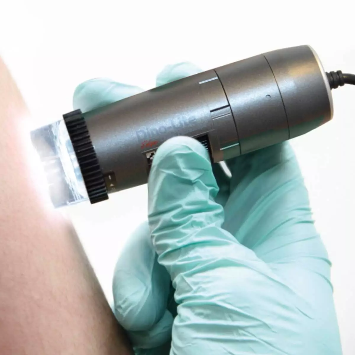  DermaScope Polarizer HR 200x videodermatoscoop