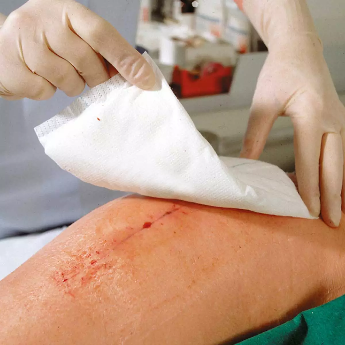 Zetuvit absorberende verbanden steriel