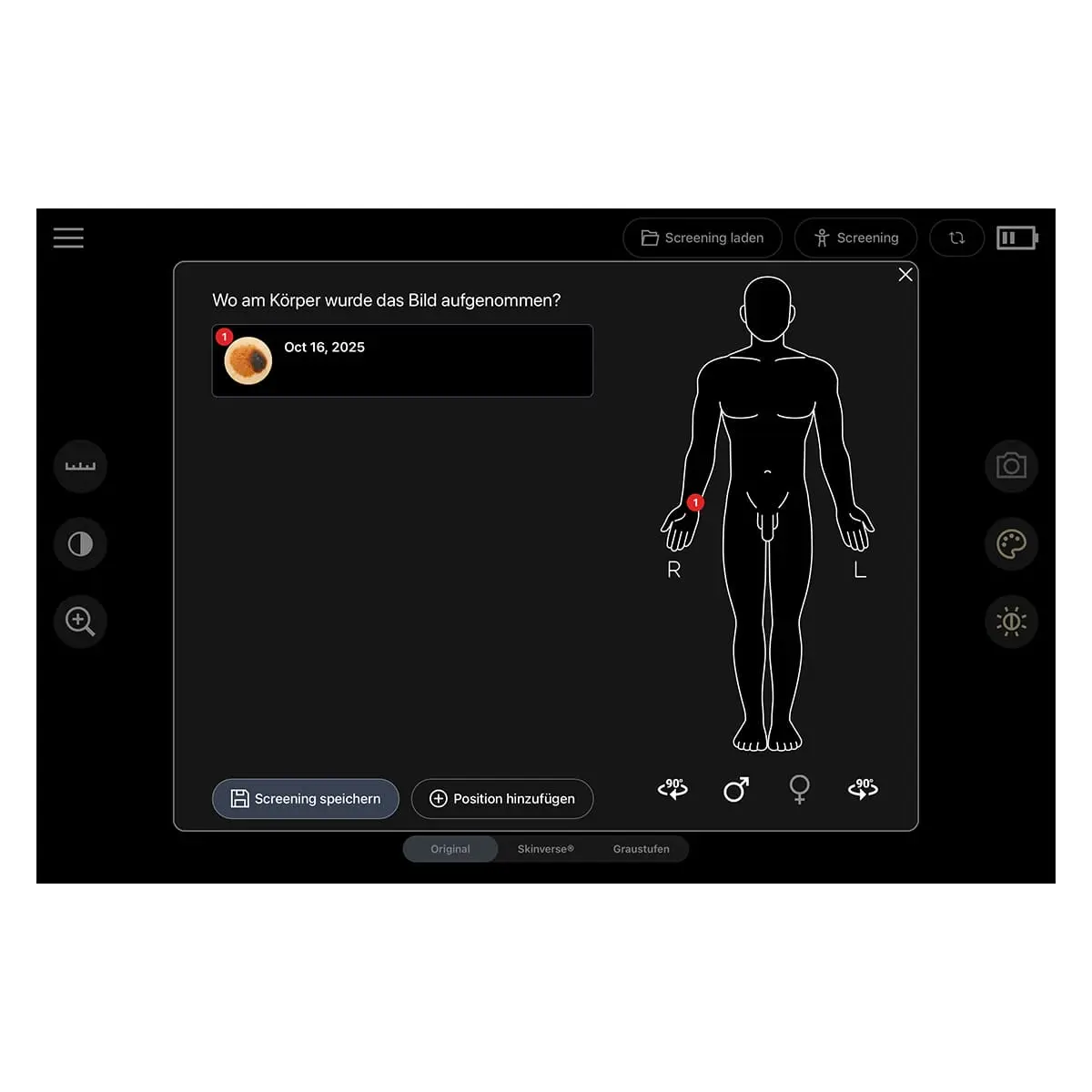  Digitale dermatoscoop ‘Scaut®’