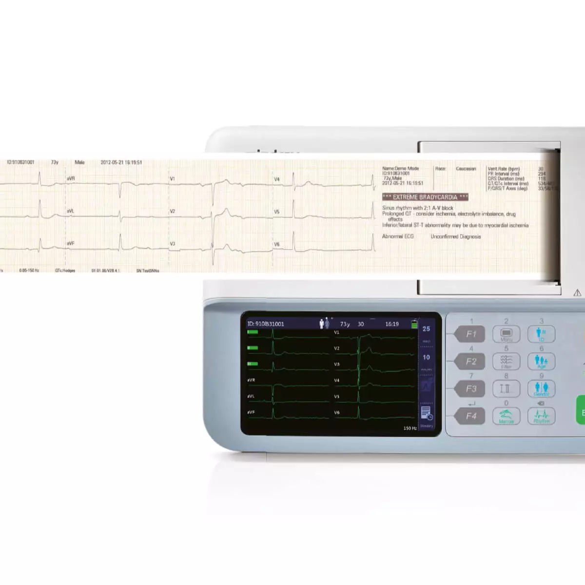  BeneHeart R3 ecg