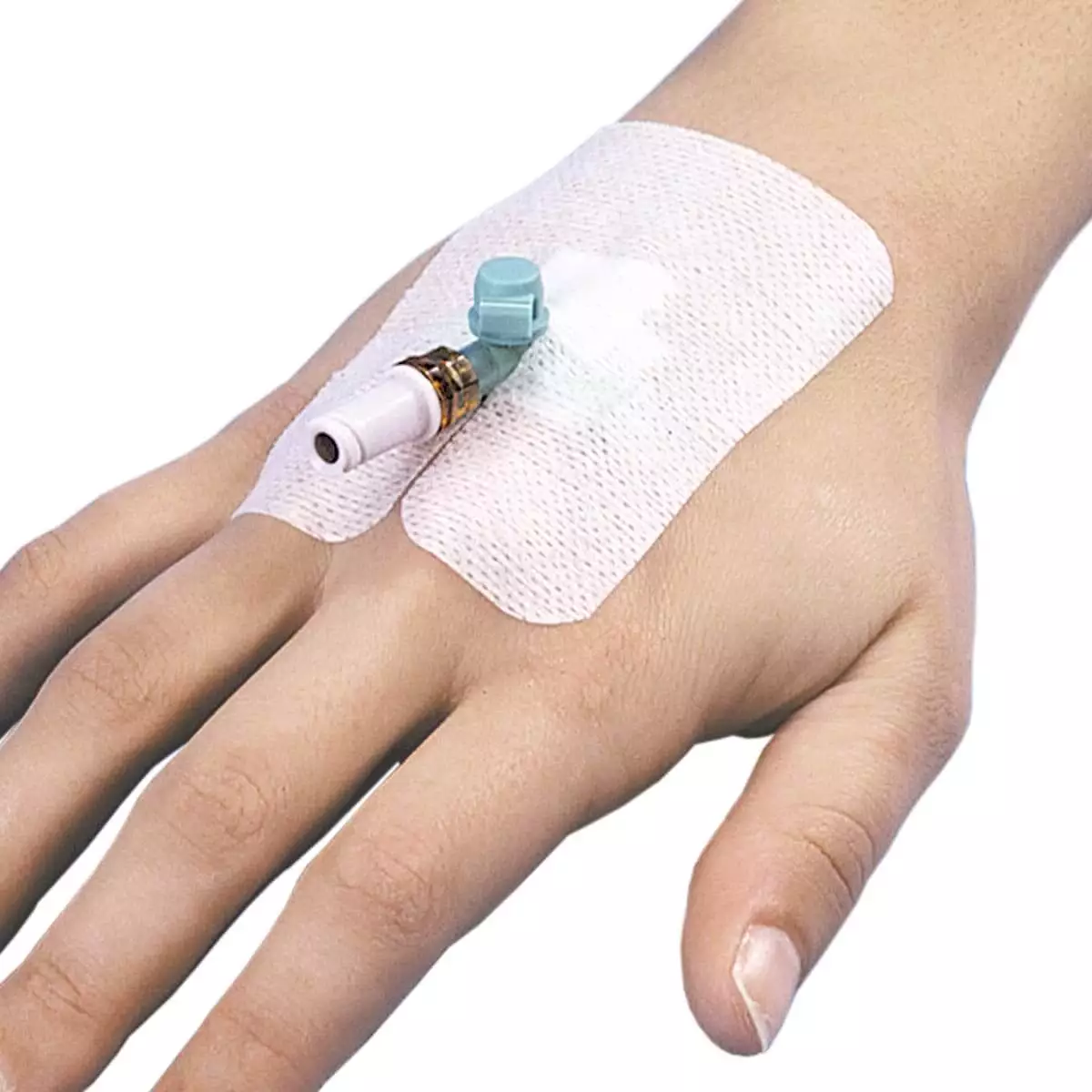  IV-verband met canuleverband