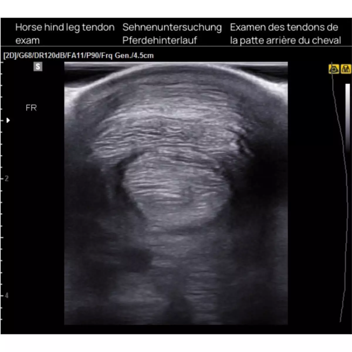  aiSon FOCUS gelpads voor echotransducers