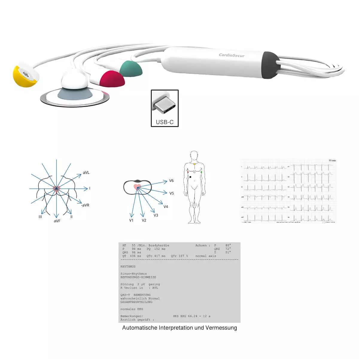  CardioSecur Pro ECG