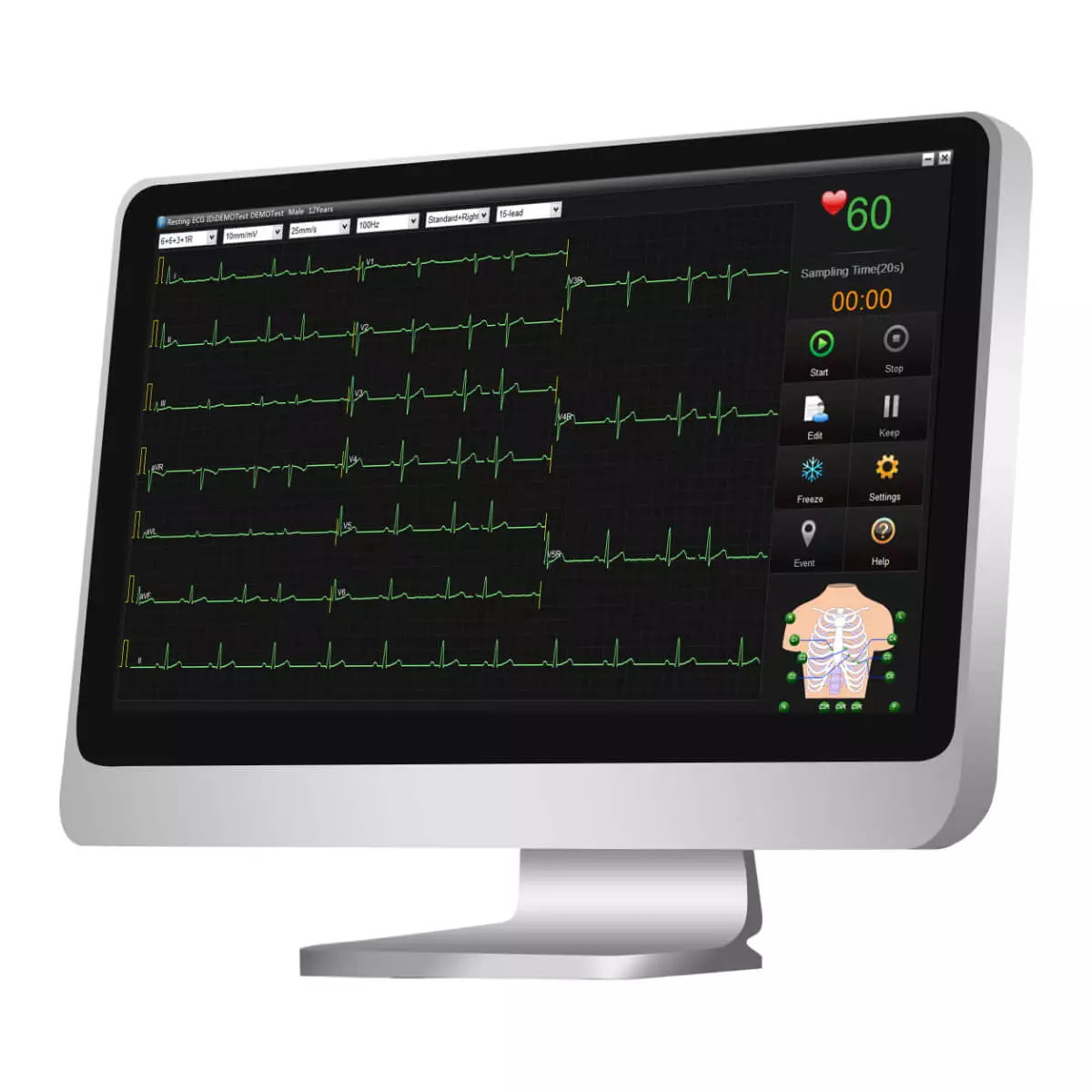  SE-1515 ECG-gegevensbeheersoftware