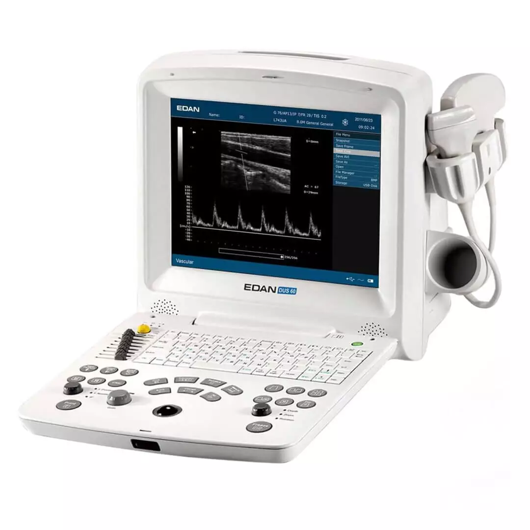  DUS 60 echografie scanner