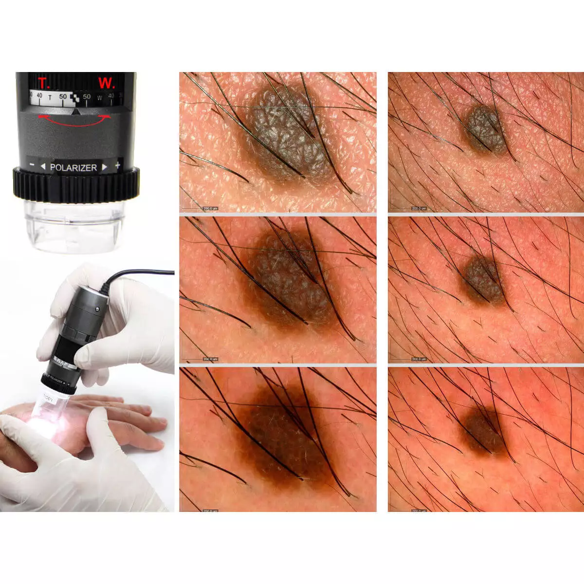  DermaScope Polarizer HR 200x videodermatoscoop