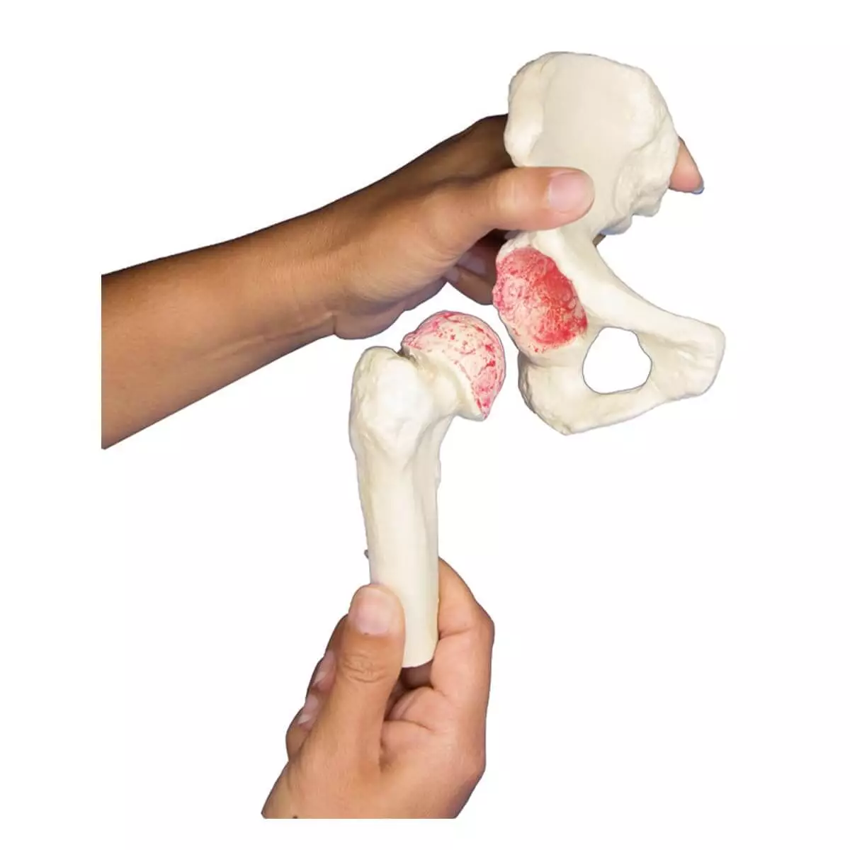  Model heupimplantaat