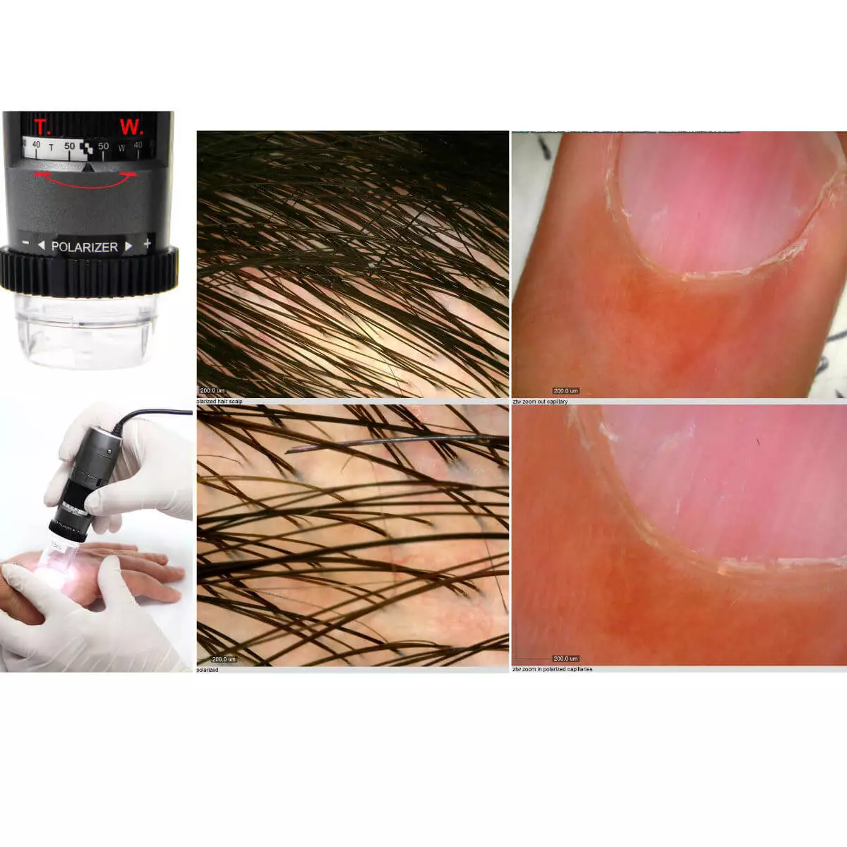  DermaScope Polarizer HR 200x videodermatoscoop